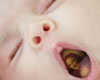 Yawning Baby